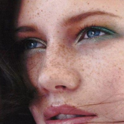 如何向“芝麻脸”说不!